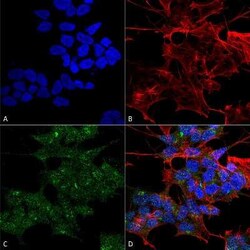 RAB1B Antibody, Novus Biologicals 100 &mu;g | Buy Online | Novus Biologicals | Fisher Scientific